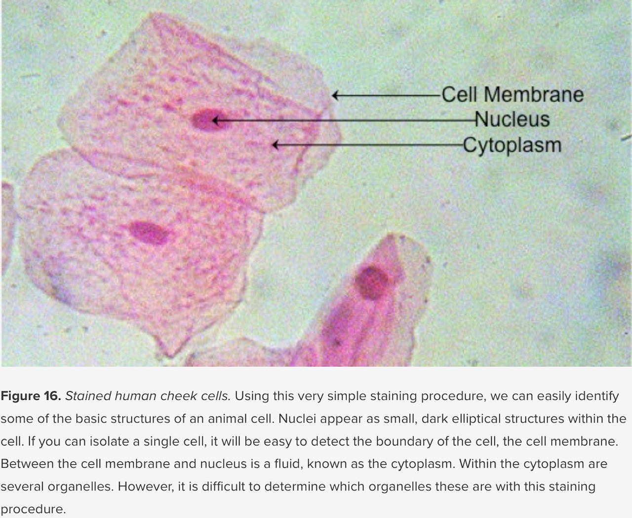 stained-human-cheek-cells